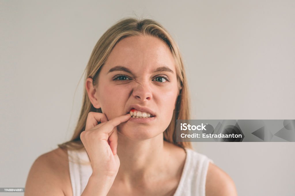 periodontal disease stages