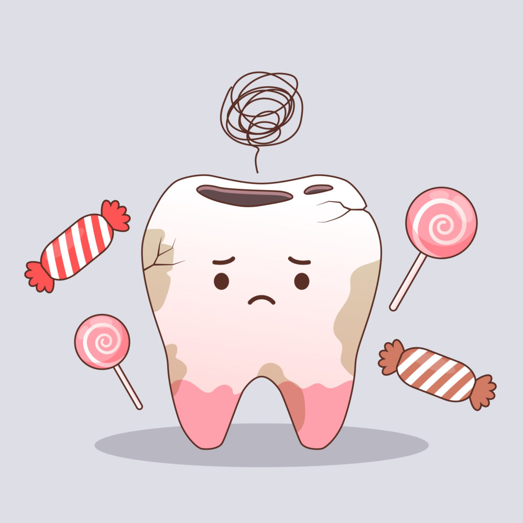 Pocket Reduction Surgery